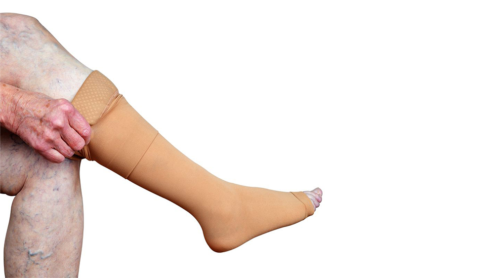 Do Compression Stockings Cure Varicose Veins? 