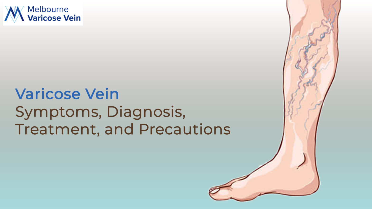 Varicose Veins: Symptoms, Diagnosis, Treatment, and Precautions