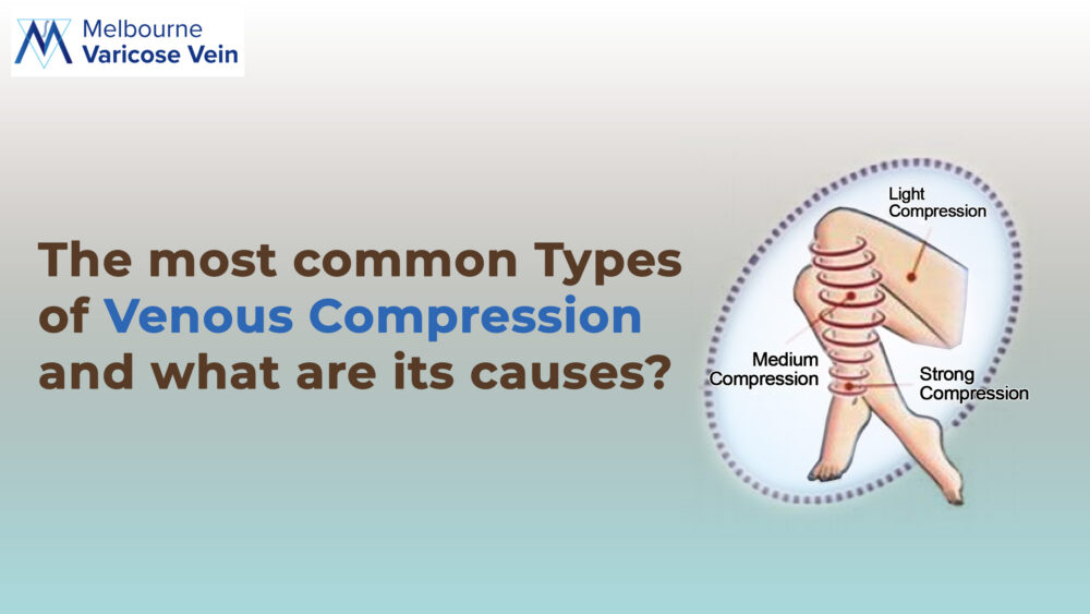 The Most Common Types of Venous Compression and what are its Causes?
