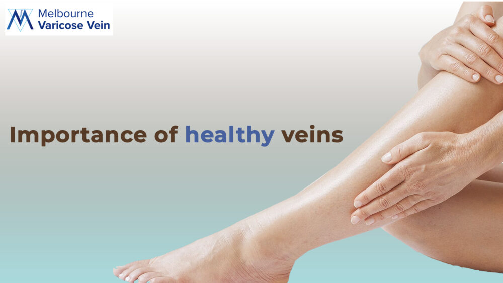 Importance of healthy veins