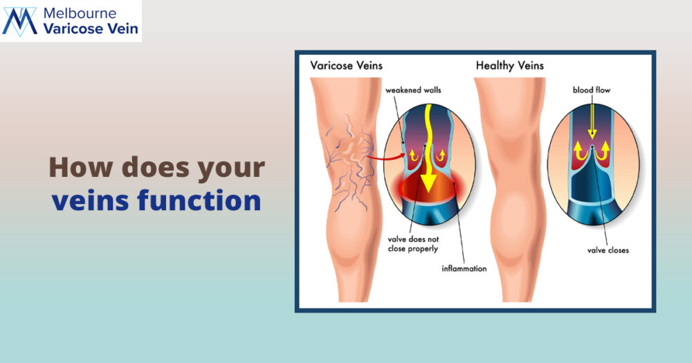 How does the vein function! - Best Vein Varicose Clinic in Victoria Melbourne